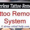 The Very High Cost Tattoo Removal