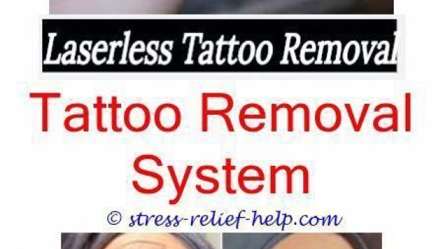 The Very High Cost Tattoo Removal