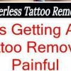 What Is The Foremost Tattoo Eliminator?