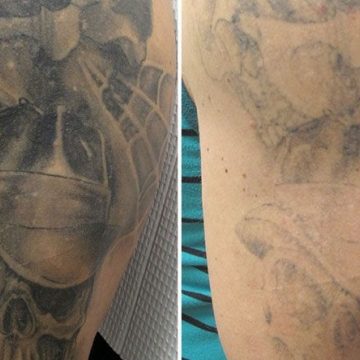 Wrecking Balm Tattoo Removal Cream Guide