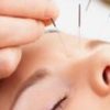 The Needle’s Healing Touch: Unlocking the Secrets of Acupuncture